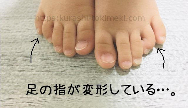 娘の足の指